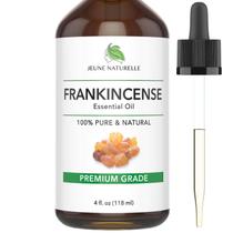 Óleo Essencial de Olíbano - 100% Puro, Natural, Grau Terapêutico para Pele, Corpo e Cabelos (120 ml)