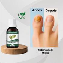 Óleo Vegetal De Melaleuca 30ml Flor Do Valle - Essencial Óleo Vegetal De Melaleuca 30ml Flor Do Valle - Essencial