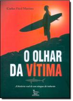 Olhar da Vítima: A História Real de um Ataque de Tubarão