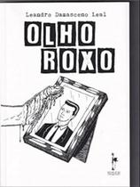 Olho roxo - REALEJO Olho roxo - REALEJO