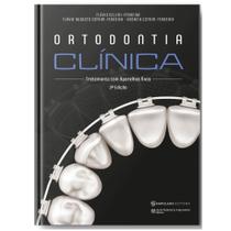 Ortodontia Clínica - Tratamento com Aparelhos Fixos - Napoleão