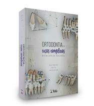 Ortodontia Em Casos Complexos - Biomecânica Racional - Tota Ortodontia Em Casos Complexos - Biomecânica Racional - Tota