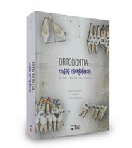 Ortodontia em casos complexos - biomecanica racional Ortodontia em casos complexos - biomecanica racional