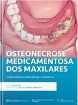 Osteonecrose Medicamentosa Dos Maxilares Implicações Na Odontologia E Medicina Osteonecrose Medicamentosa Dos Maxilares Implicações Na Odontologia E Medicina