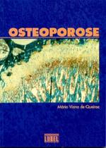 Osteoporose Osteoporose