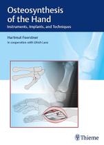 Osteosynthesis of the hand - THIEME MEDICAL PUBLISHERS/MAPLE PRESS