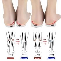 Palmilhas Ortopédicas Unissex De Gel De Silicone Para Correção De Pernas Tipo O/X E Valgo, Com