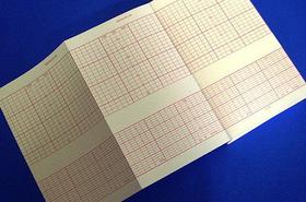 PAPEL TERMOSSENSÍVEL Pzz- ECG TITS 114X70X200FLS