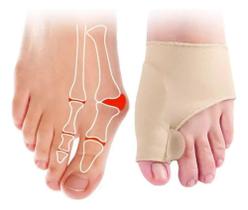 Par Meias Ortopédicos Protetor Corretor Joanetes Separador