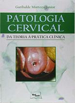 Patologia Cervical Da Teoria à Prática Clínica