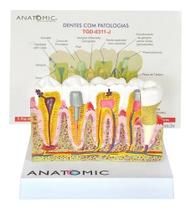 Patologia Dentária e Placa Explicativa em 2 Partes, Anatomia