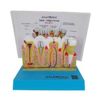 Patologia Dentária e Placa Explicativa em 2 Partes, Anatomia