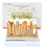 Patologia Dentária E Placa Explicativa Em 2 Partes, Anatomia