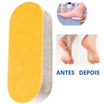 Pedra pomes anatomica com lixa