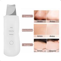 Peeling Ultrassônico 3 em 1 Para Limpeza Profunda e Lifting Facial