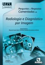 Perguntas e respostas comentadas de radiologia e diagnostico por imagem - LIVRARIA E EDITORA RUBIO LTDA Perguntas e respostas comentadas de radiologia e diagnostico por imagem - LIVRARIA E EDITORA RUBIO LTDA