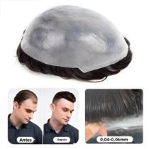 Peruca Masculina De Cabelo Humano Com Linha De Cabelo Natural E Sistema De Próteses Capilares De Nó Peruca Masculina De Cabelo Humano Com Linha De Cabelo Natural E Sistema De Próteses Capilares De Nó