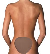 Placa Contenção Costas Sacral Cóccix Cirurgia Plástica Placa Contenção Costas Sacral Cóccix Cirurgia Plástica