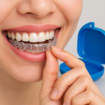 Placas Bruxismo Moldeira de Silicone Molde Caseiro Aparelho Protetor Inferior e Superior + ESTOJO Placas Bruxismo Moldeira de Silicone Molde Caseiro Aparelho Protetor Inferior e Superior + ESTOJO