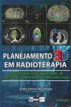 Planejamento 3d Em Radioterapia