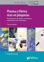 Plasma y fibrina rico en plaquetas - Ediciones Journal Sa