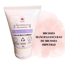 Pomada antifúngica óxido de zinco e calêndula Pomada antifúngica óxido de zinco e calêndula