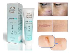 Pomada Creme Alantoína Para Estrias E Cicatrizes DermaTriz 20g.