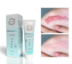 Pomada Creme De Cicatriz Eficaz Regeneração Da Pele 20g DermaTriz