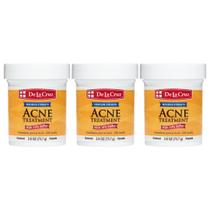 Pomada de Enxofre 10% De La Cruz - Tratamento para Acne (3 Unidades) Pomada de Enxofre 10% De La Cruz - Tratamento para Acne (3 Unidades)