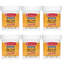 Pomada de Enxofre De La Cruz 10% Tratamento para Acne 6x73,7g