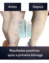 Pomada em Gel suavizante Cicatriz 20 g DermaTriz