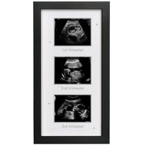Porta-retratos de ultrassom HAMUIERS Triple 13x18cm preto