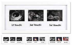 Porta-retratos IHEIPYE Triple Sonogram Gravidez Branco 41x16cm Porta-retratos IHEIPYE Triple Sonogram Gravidez Branco 41x16cm