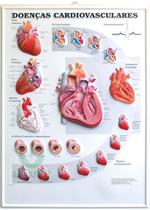 Pôster 3D de Doenças Cardiovasculares em Alto-Relevo