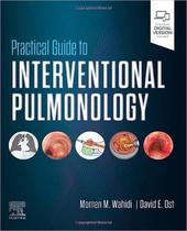 Practical Guide to Interventional Pulmonology - Elsevier (import) Practical Guide to Interventional Pulmonology - Elsevier (import)