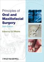 Principles of oral and maxillofacial surgery