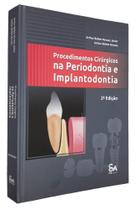 Procedimentos cirúrgicos na periodontia e implantodontia - SANTOS PUB
