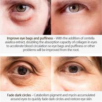 Produtos Tratamento Ouro 24K Olheiras - Serum Para Os Olhos Peeling Ol