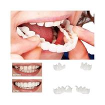 Prótese Cosmética Confortável Para Dentes Superiores E Inferiores Com Cola De Gutta Percha - NONE