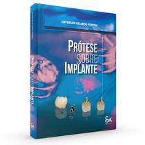 PRÓTESE SOBRE IMPLANTE 1a EDIÇÃO - EDITORA Santos Publicações