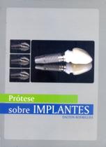 Protese sobre implantes - IDEA EDITORA