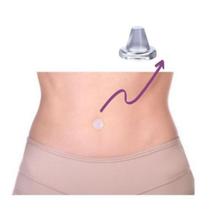 Protetor De Umbigo Esférica Anatômica Pós Cirurgia - Tima Un Protetor De Umbigo Esférica Anatômica Pós Cirurgia - Tima Un