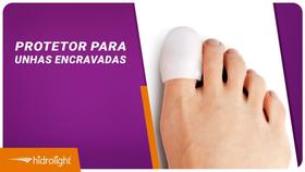 Protetor para Unhas Encravadas - Hidrolight Protetor para Unhas Encravadas - Hidrolight