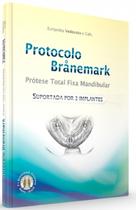 Protocolo Branemark Prótese Total Fixa Mandibular Suportada por 3 Implantes - Santos Publicações