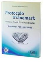 Protocolo Branemark Prótese Total Fixa Mandibular Suportada por 3 Implantes - Santos Publicações Protocolo Branemark Prótese Total Fixa Mandibular Suportada por 3 Implantes - Santos Publicações