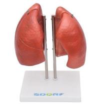 Pulmão Segmentado Humano 4 Partes Pulmão Segmentado Humano 4 Partes