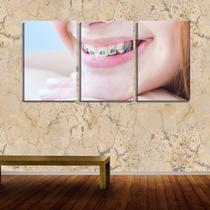 Quadro canvas 45x96 sorriso com aparelho odonto