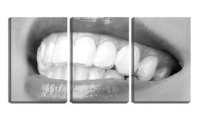 Quadro Decorativo 68x126 dentes brancos dentista pb
