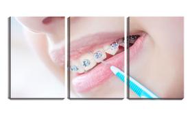 Quadro Decorativo 68x126 limpeza de aparelho dentário