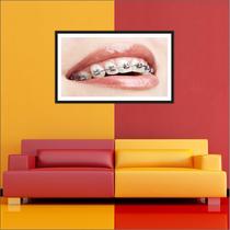 Quadro Decorativo Consultório Dentista Decoração Aparelho